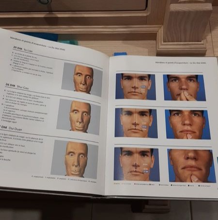 Livres lot Acupuncture Les Points Essentiels - Atlas Illustré d'Acupuncture Seirin