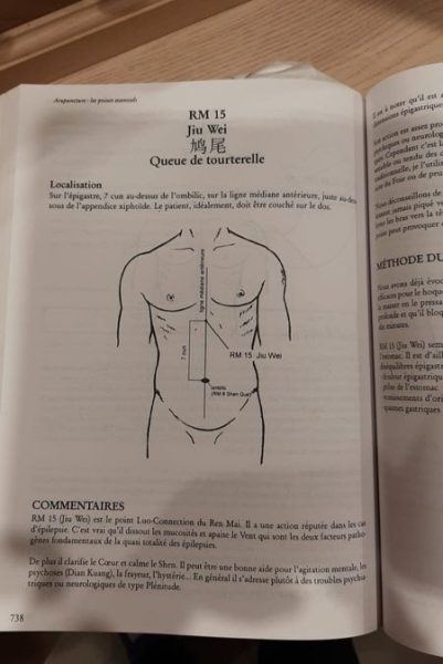 Livres lot Acupuncture Les Points Essentiels - Atlas Illustré d'Acupuncture Seirin